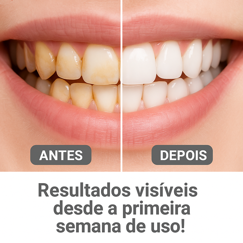 Irrigador Dental Oral Portátil Recarregável - [LIMPEZA BOCAL JATO FORTE]