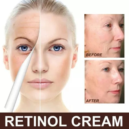 EternaGlow - Antienvelhecimento Retinol Removedor de Rugas Natural