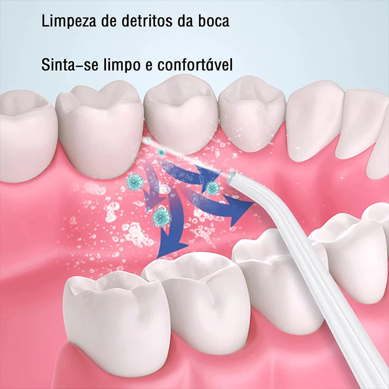Irrigador Dental Oral Portátil Recarregável - [LIMPEZA BOCAL JATO FORTE]